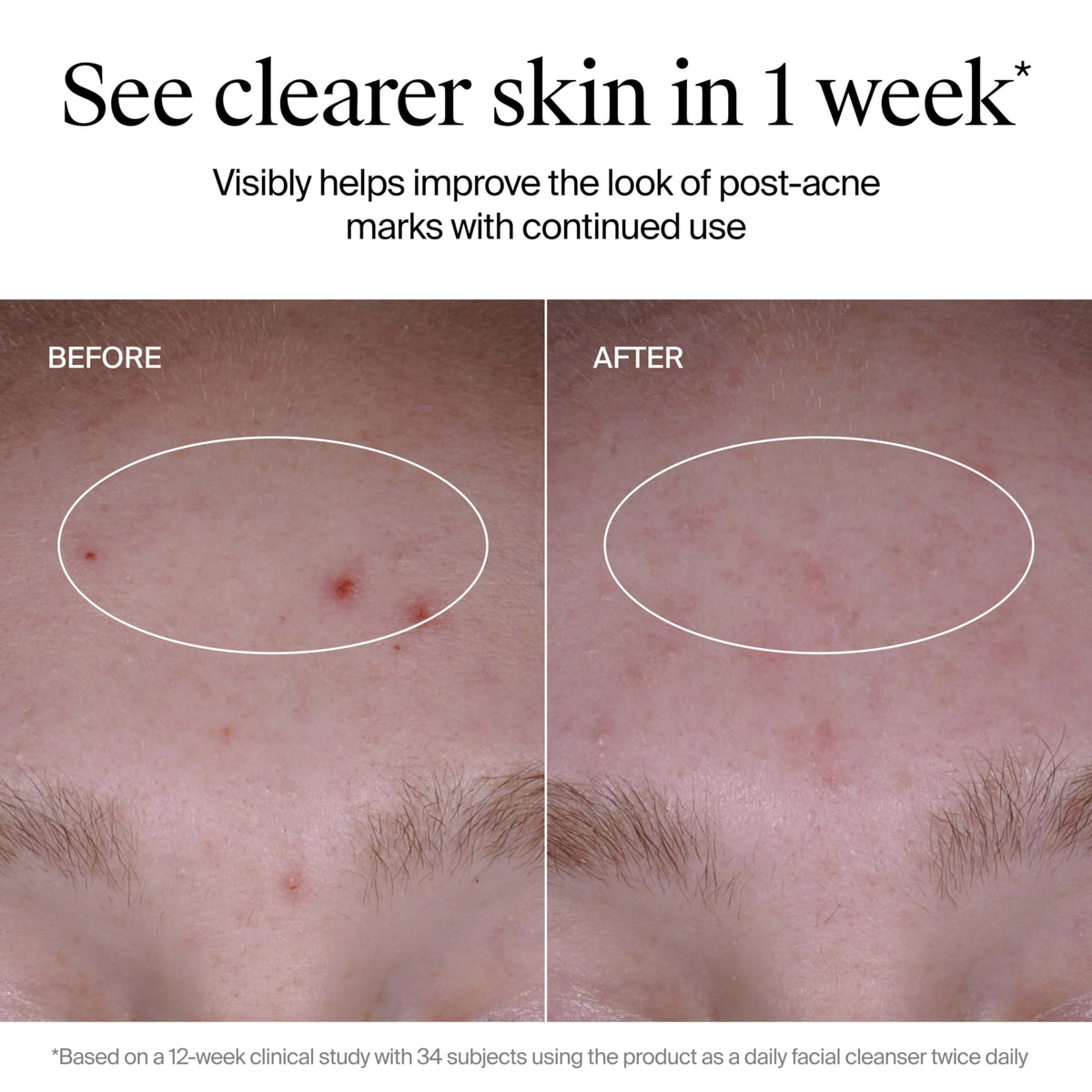 Neutrogena Evenly Clear Acne Cleanser texture on hand