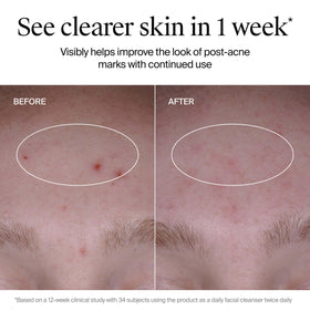 Neutrogena Evenly Clear Acne Cleanser texture on hand