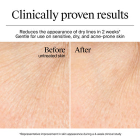 Neutrogena Hydro support Gel Cream application on skin