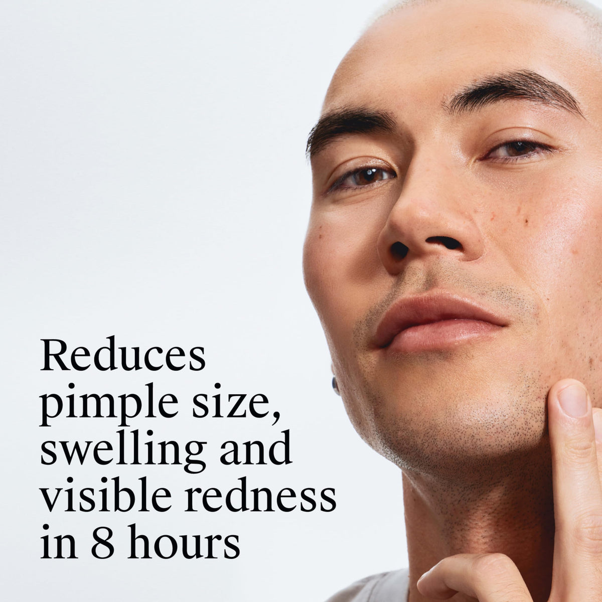 Neutrogena Rapid Clear Acne Face Pads usage demonstration