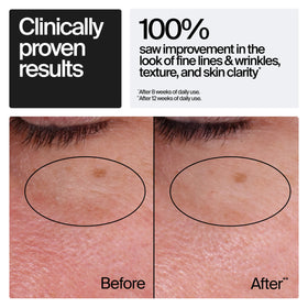 Neutrogena Retinol Regenerating Cream jar side view