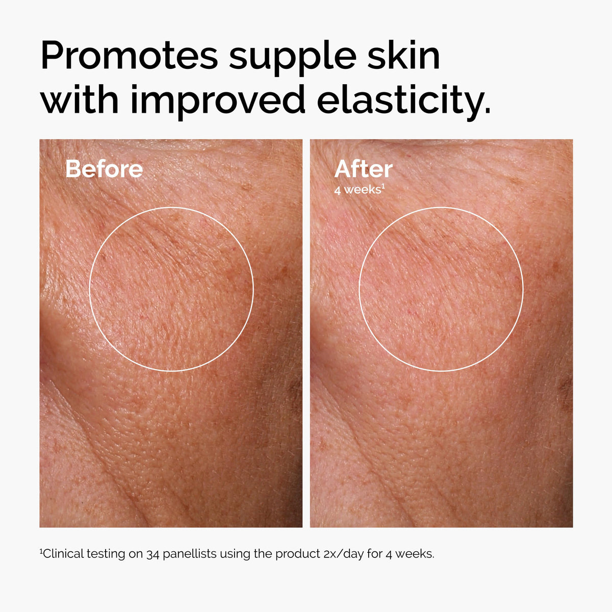 Niacinamide 10% + Zinc serum bottle