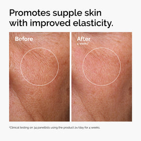 Niacinamide 10% + Zinc serum bottle