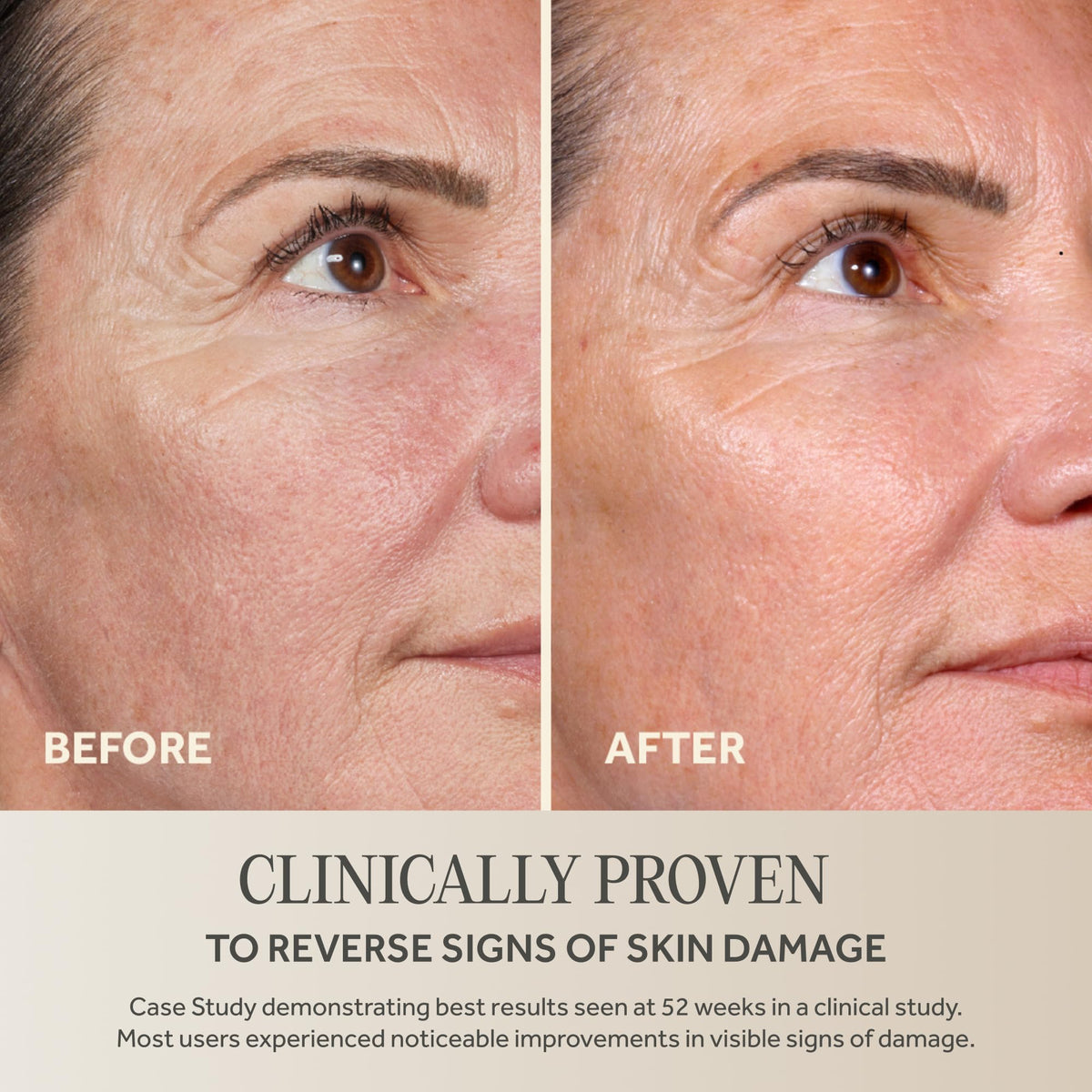 No7 Future Renew Damage Reversal Face Serum with key ingredients displayed