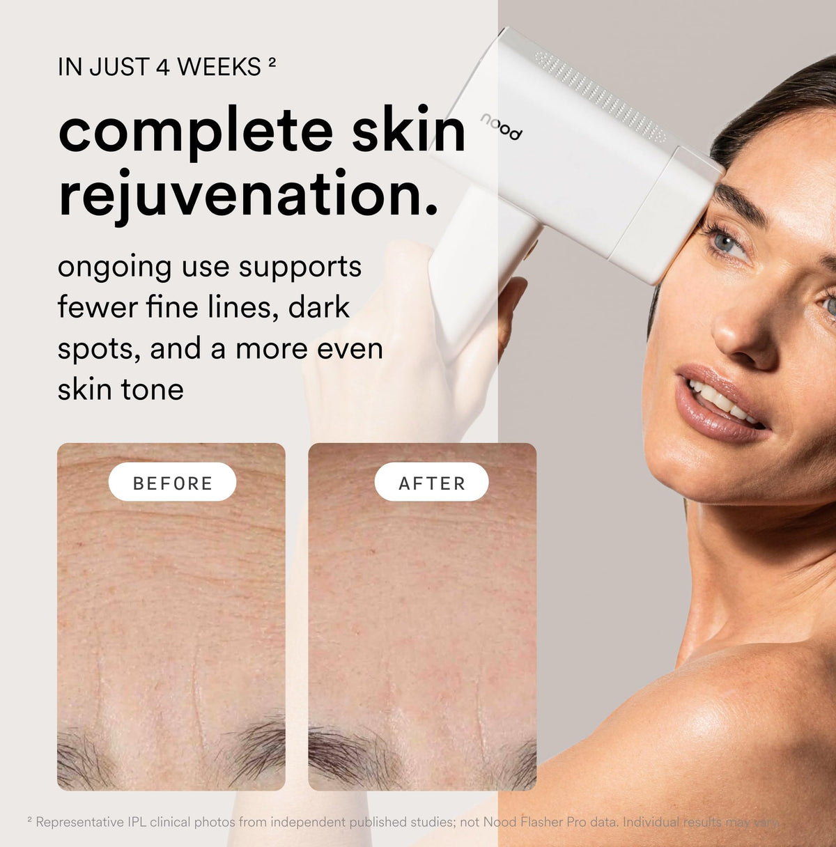 Nood Flasher Pro IPL device in a lifestyle setting
