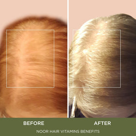 NOOR HAIR Healthy Hair Formula bottle with a measuring tape