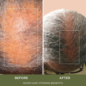 NOOR HAIR Healthy Hair Formula ingredients list close-up