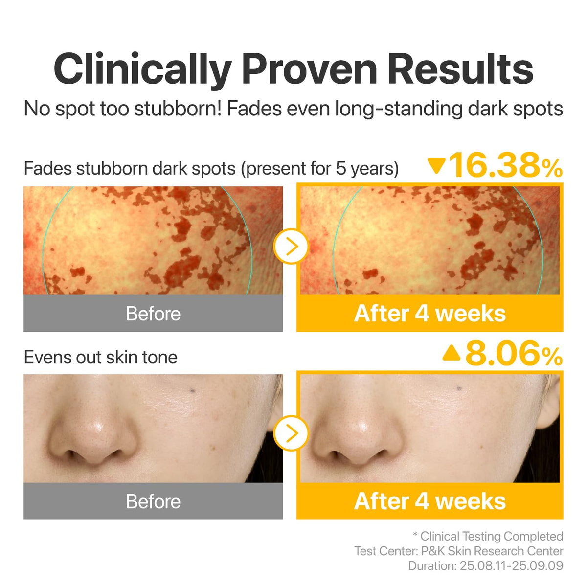 numbuzin No.5 Glutathione TXA Dark Spot Ampoule in lifestyle setting
