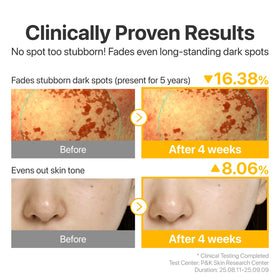 numbuzin No.5 Glutathione TXA Dark Spot Ampoule in lifestyle setting