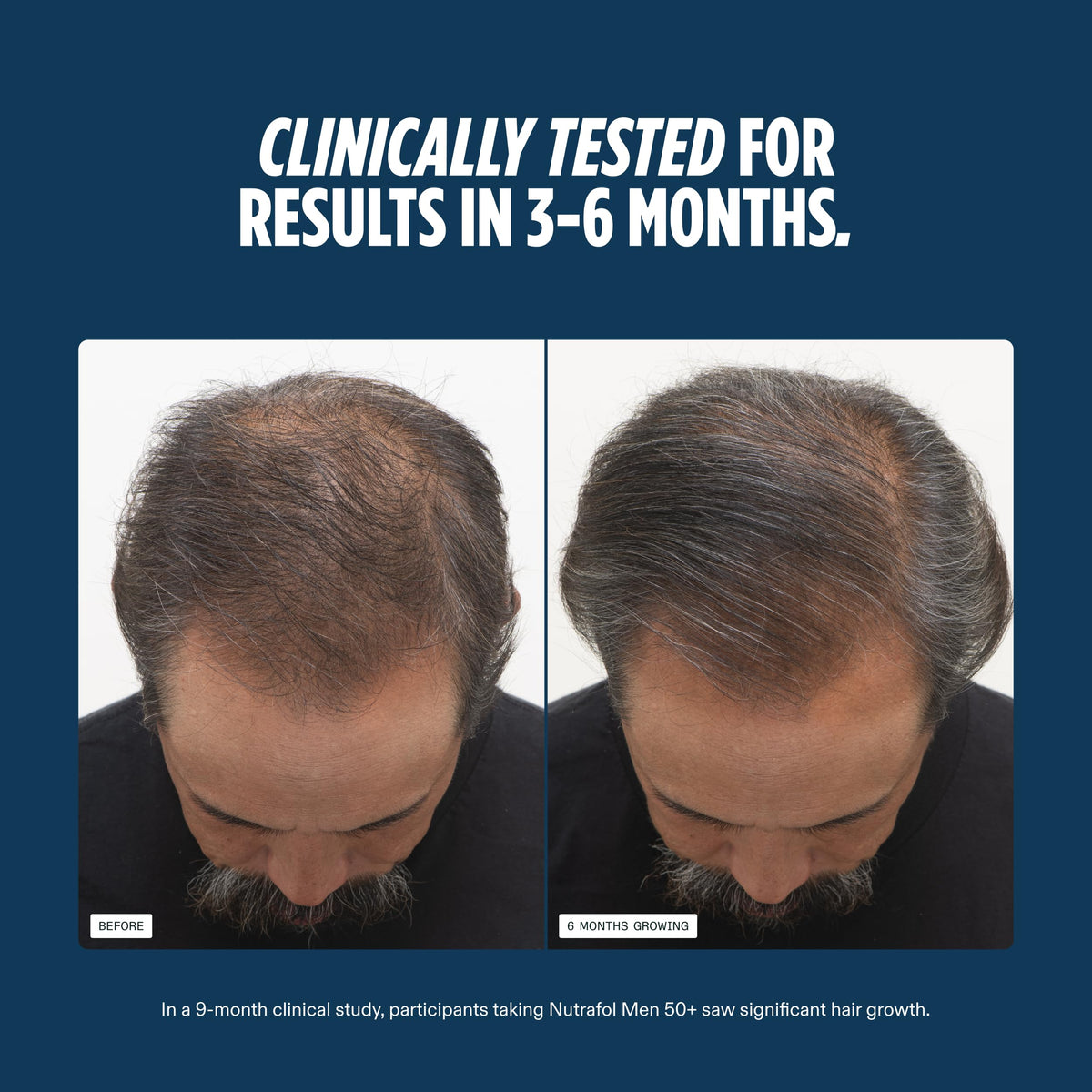 Nutrafol Men 50+ Hair Growth Supplements ingredients list