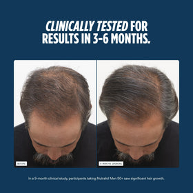 Nutrafol Men 50+ Hair Growth Supplements ingredients list