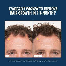 Nutrafol Men Hair Growth Supplements 1-Month Pouch side view
