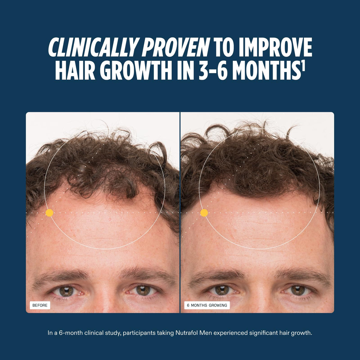 Nutrafol Men Hair Growth Supplements packaging details
