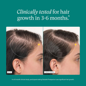 Nutrafol Postpartum Hair Growth Supplements ingredients list