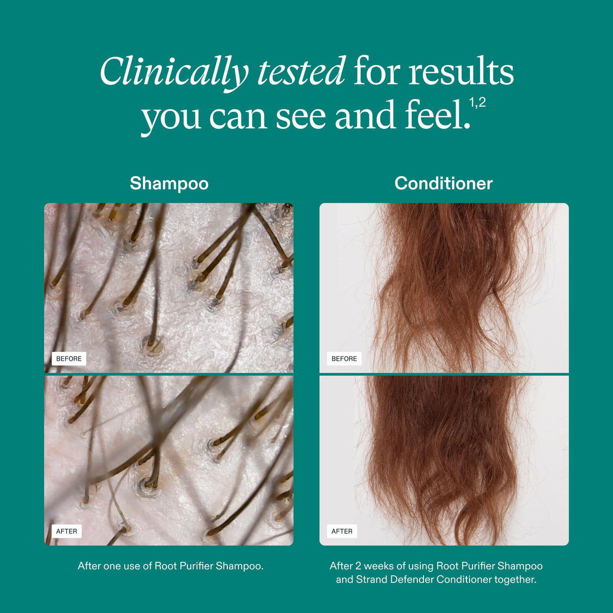 Nutrafol Shampoo and Conditioner set in giftable packaging