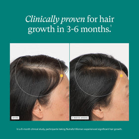 Nutrafol Women Hair Growth Supplements packaging side view