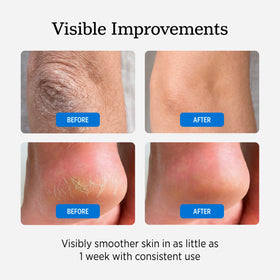 NUVADERMIS 40% Urea Cream showing ingredient list
