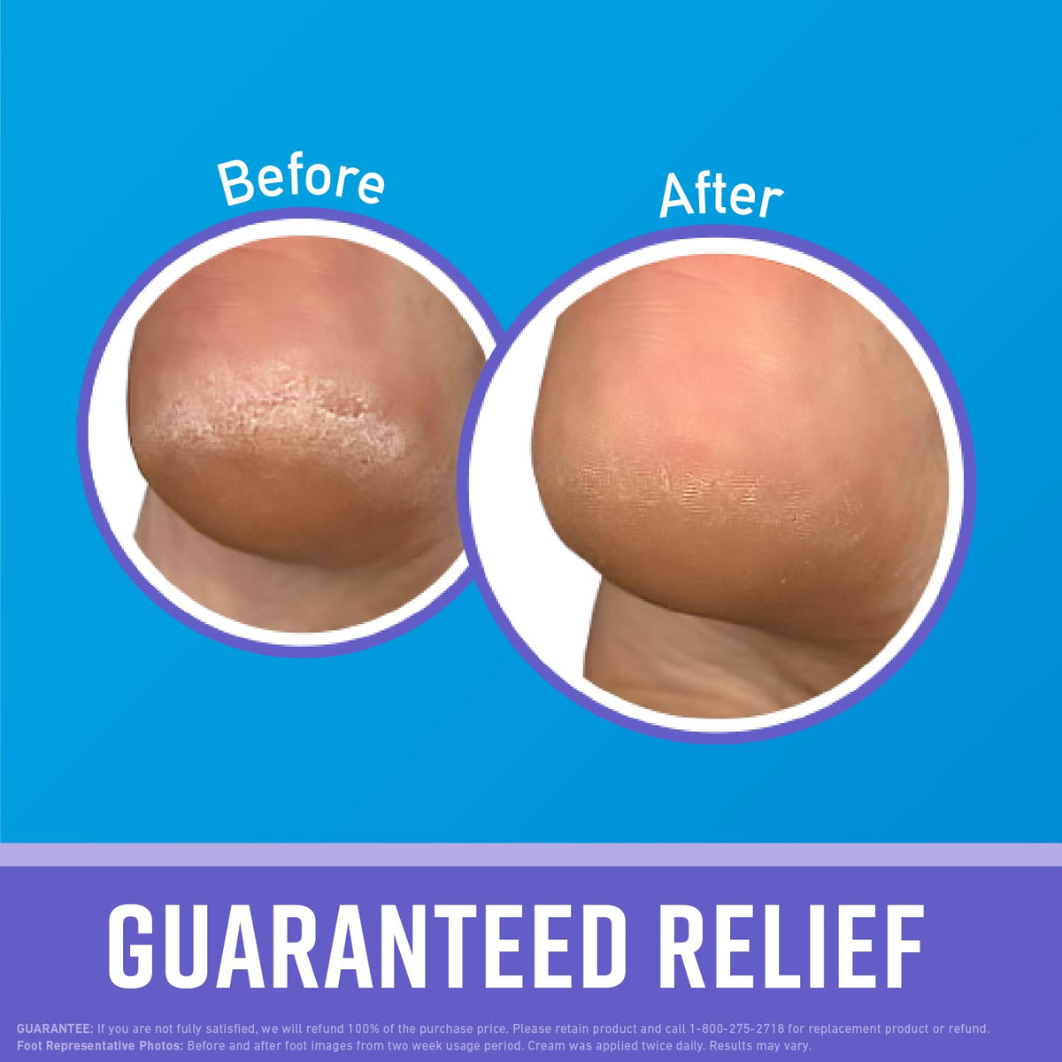 O'Keeffe's Healthy Feet Night Cream texture close-up