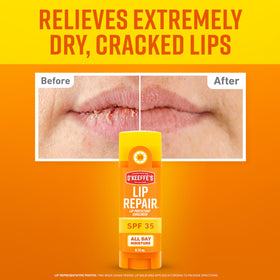 O'Keeffe's Lip Repair SPF 35 Balm back view with ingredients