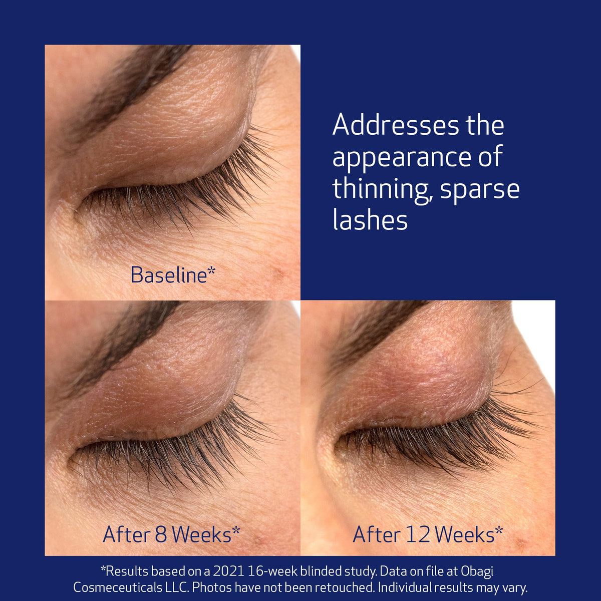 Obagi Nu-Cil Eyelash support Serum packaging details