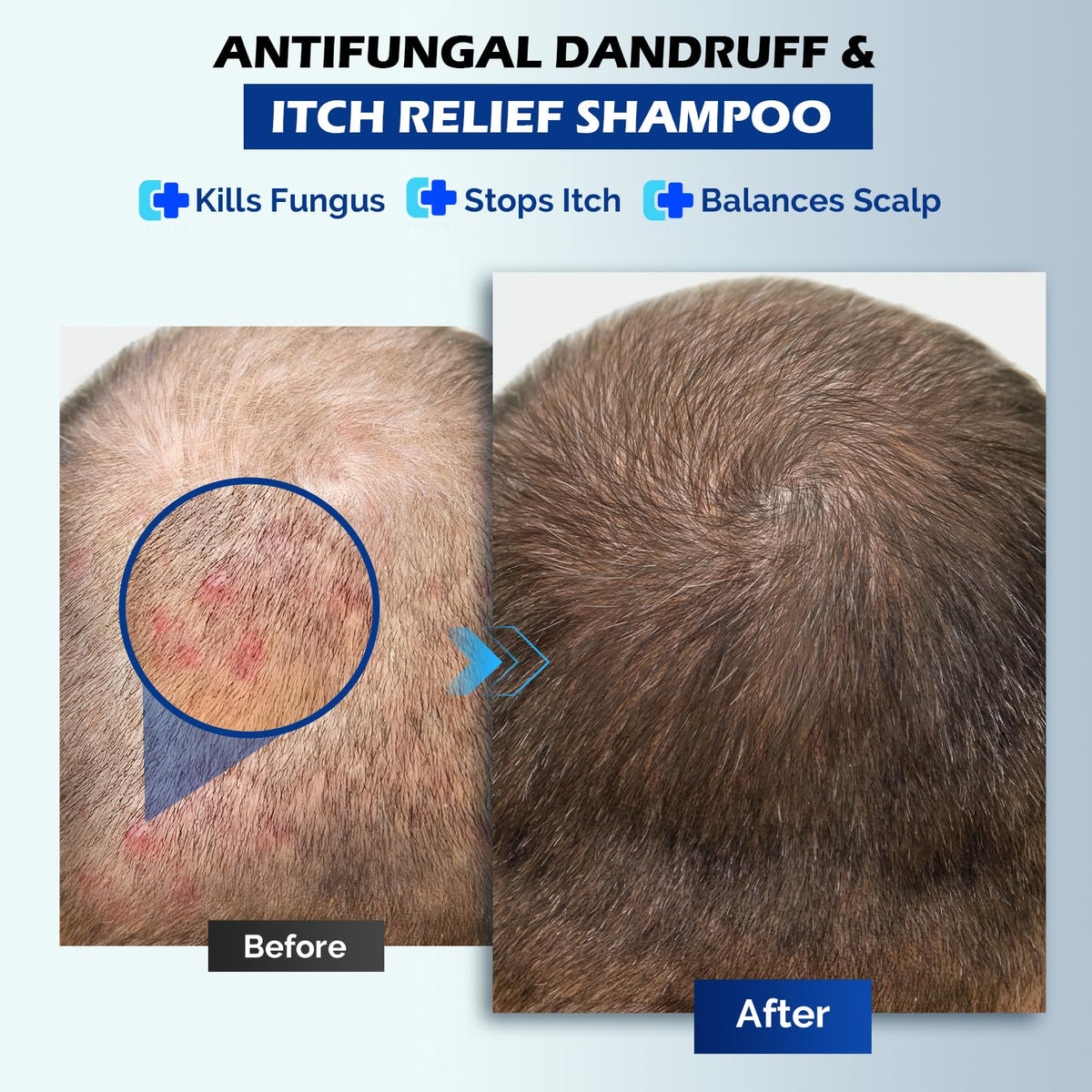 oely Antifungal Shampoo 345g back view with ingredients