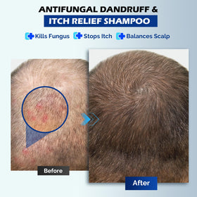 oely Antifungal Shampoo 345g back view with ingredients