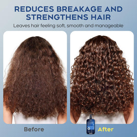 oely Deep Moisturizing Folliculitis Conditioner with mint and tea tree oil