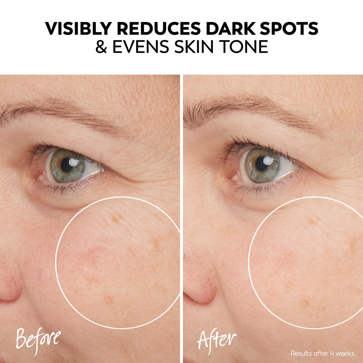 Olay Pro-X Even Skin Tone Serum texture close-up