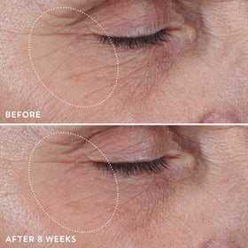Olay Regenerist Under Eye Cream Roller application on skin