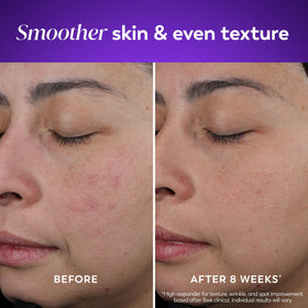 Olay Retinol Night Cream texture close-up
