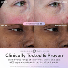 Olay Super Serum in a skincare routine