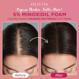 OLIVITA 5% Minoxidil Foam application on scalp