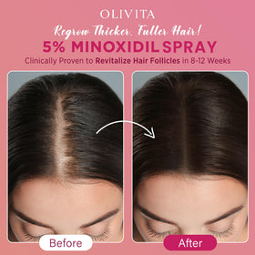 OLIVITA 5% Minoxidil Spray packaging details