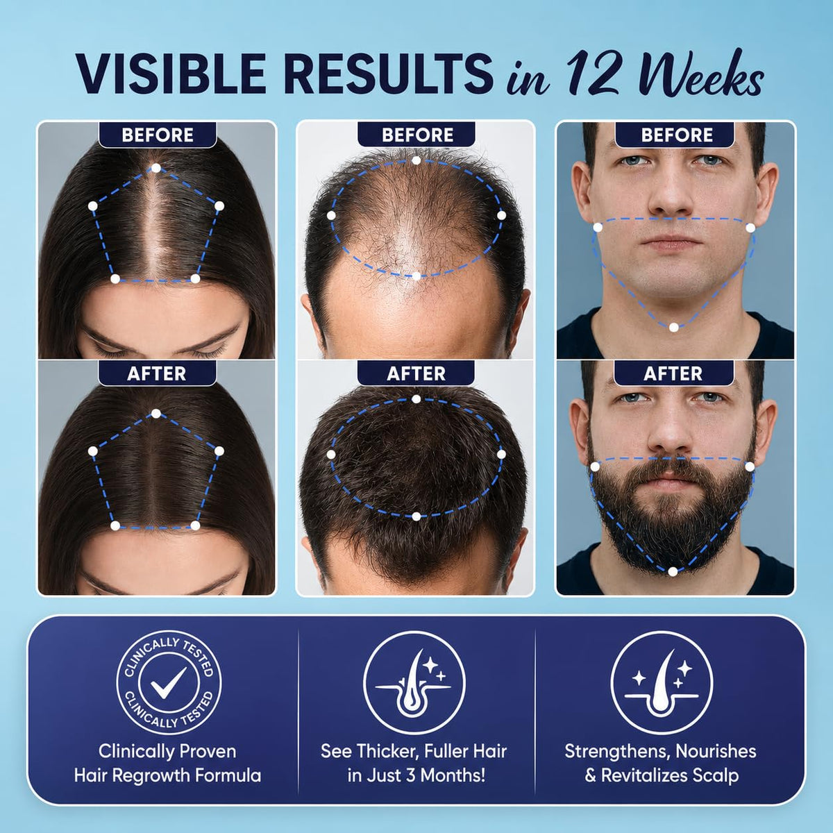 OLIVITA Hair Growth Serum 5% Minoxidil application on hair