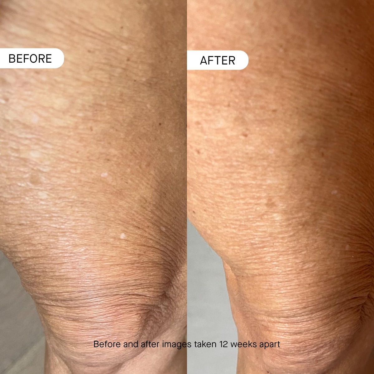 oneskin OS-01 BODY Moisturizer 8.45 Oz texture close-up