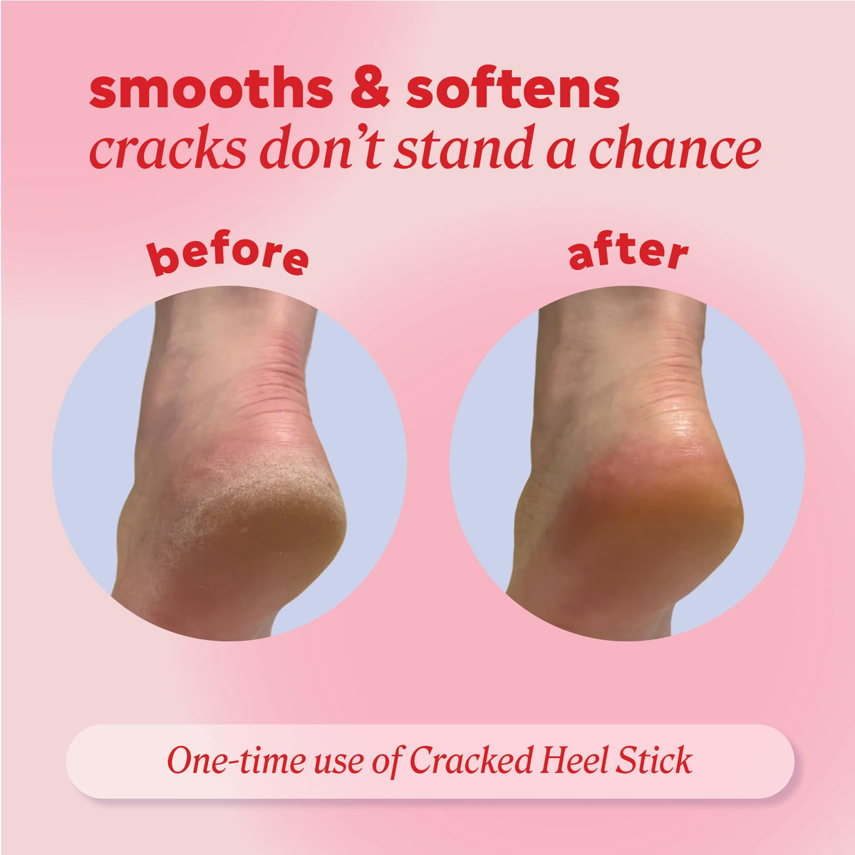 Onyx Professional Cracked Heel Repair Balm Stick applied on dry feet