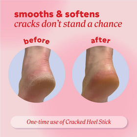 Onyx Professional Cracked Heel Repair Balm Stick applied on dry feet