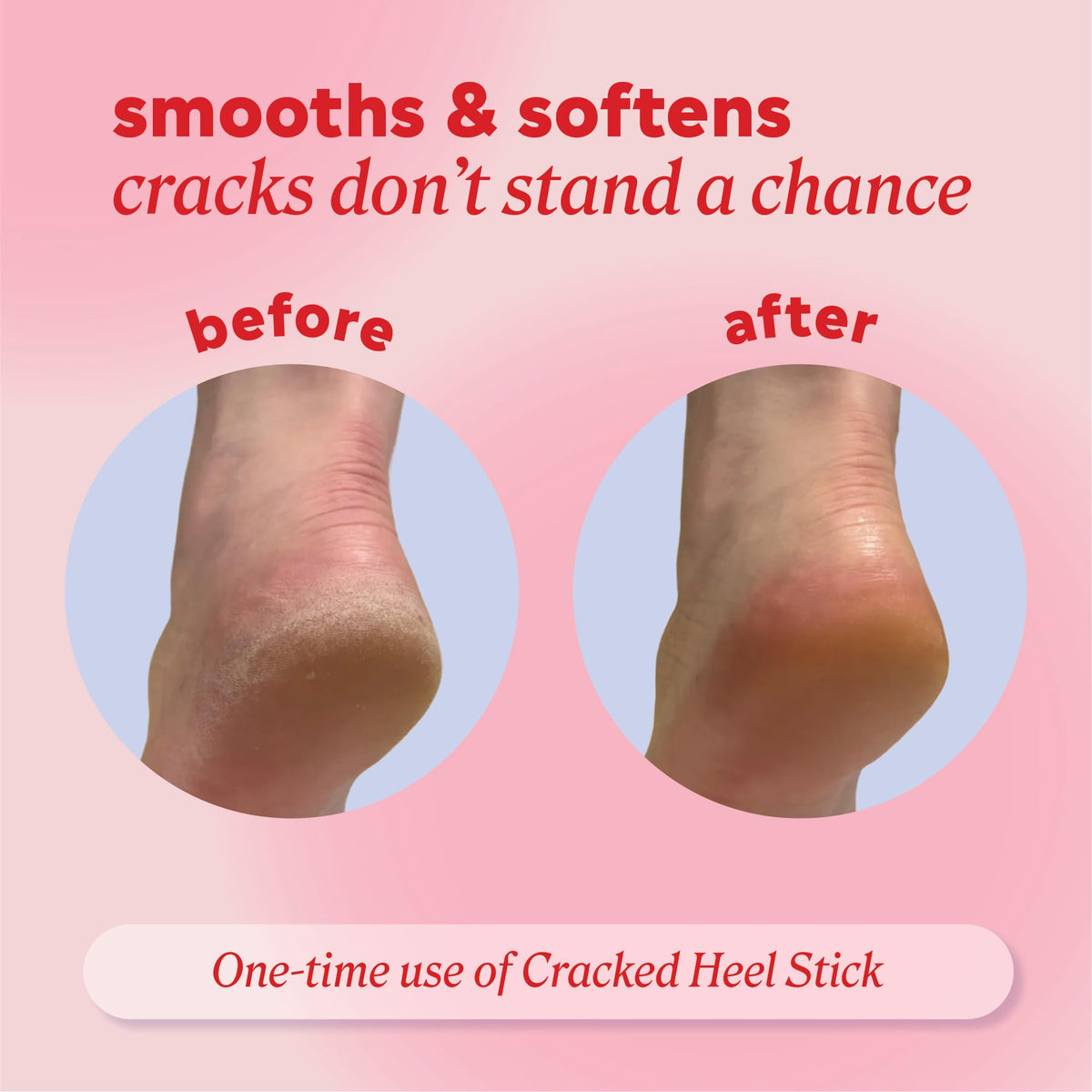 Onyx Professional Cracked Heel Repair Balm Stick close-up of texture