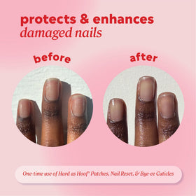 Onyx Professional Nail Repair Patches in use on fingers
