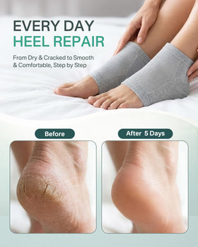 Originbuty moisturizing socks with gel heel pads