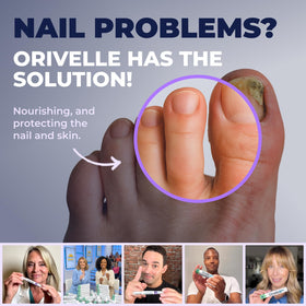 Orivelle Toenail Care Pen showing ingredients list