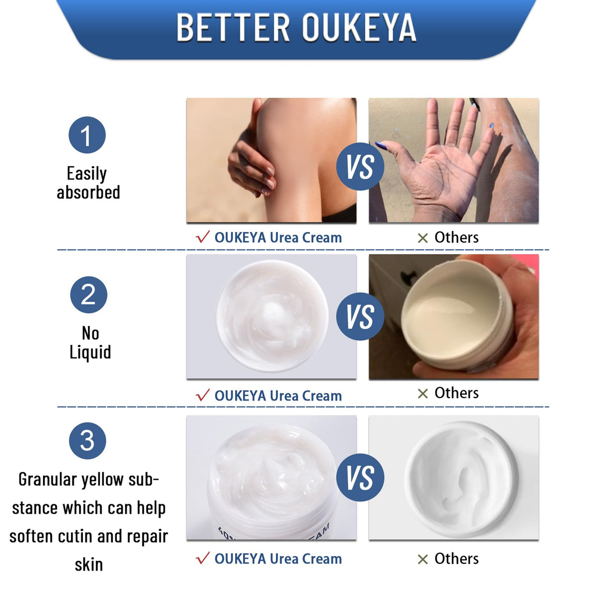 OUKEYA 40% Urea Cream application on hand
