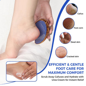 OUKEYA 42% Urea Cream application on foot