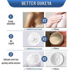 OUKEYA 42% Urea Cream for feet and elbows