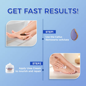 OUKEYA foot cream and file set packaging