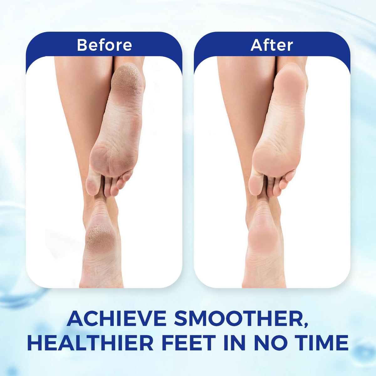 OUKEYA foot file removing dead skin
