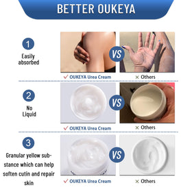 OUKEYA Urea Cream 40% application on dry feet
