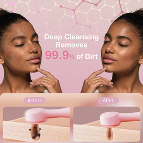 OUTIFUO Facial Cleansing Brush side view showing silicone bristles