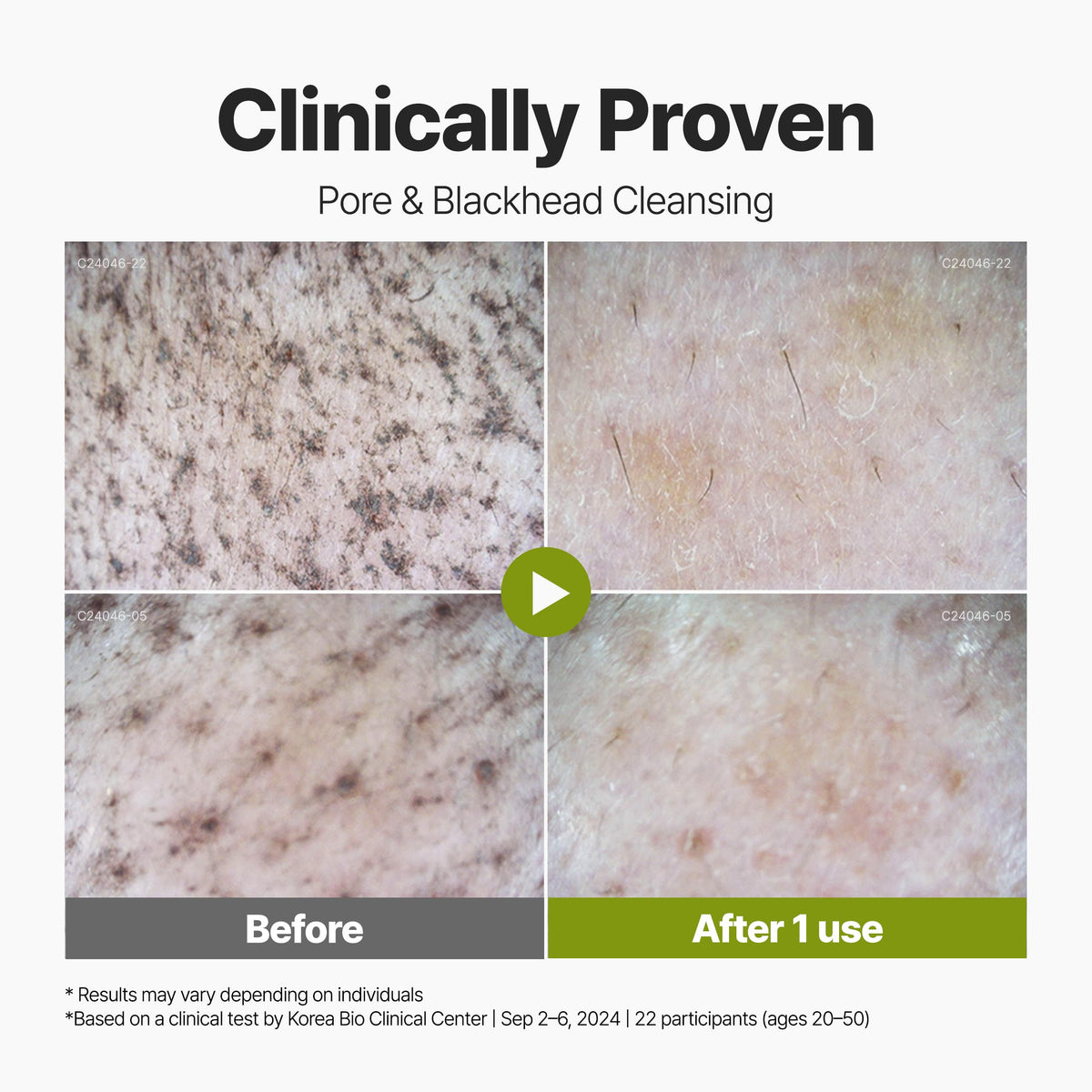 P.CALM Holy Basil Bubble Deep Mask application on skin