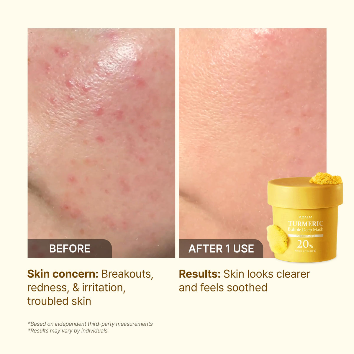 P.CALM Turmeric Bubble Deep Mask 90g ingredients list